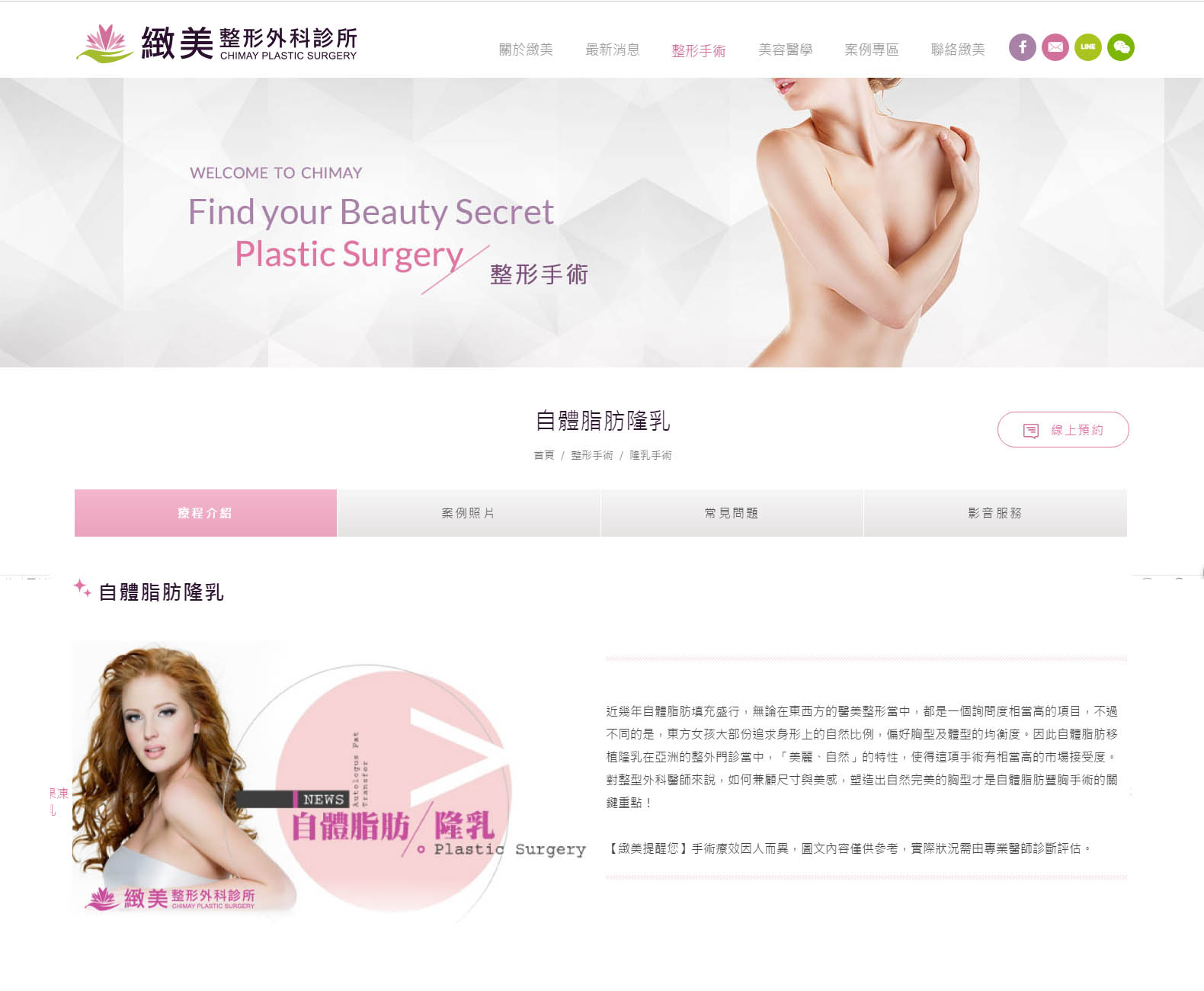 自體脂肪豐胸-緻美豐胸專科